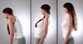 Head Forward Posture, Lordosis, Kyphosis