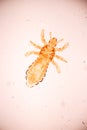 The head louse Pediculus humanus capitis is a parasite Live on the body.