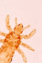 The head louse Pediculus humanus capitis is a parasite Live on the body.