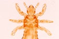 The head louse Pediculus humanus capitis is a parasite Live on the body.