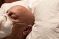 Head of a man wearing a respirator, asleep on hospital pillow, bald chemotherapy coronavirus, creative copy space Royalty Free Stock Photo