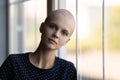 Millennial woman with shaved head suffering from oncological disease Royalty Free Stock Photo