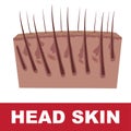 Head skin scheme