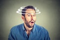 Head is spinning. Surprise astonished man Royalty Free Stock Photo