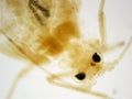 Cotton worm head 100x Magnification