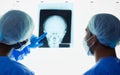 Head xray, doctors and healthcare team planning test results, charts and advice for medical analysis. Radiology Royalty Free Stock Photo