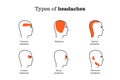 Headache location by type infographic Royalty Free Stock Photo