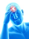 Headache/megrim Royalty Free Stock Photo
