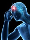 Headache/migrim Royalty Free Stock Photo