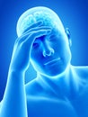 Headache/migrim Royalty Free Stock Photo