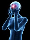 Headache/migrim Royalty Free Stock Photo