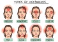 Headache types