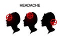 Headaches in women. migraine. anesthesia.
