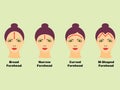 Heads of women with different types of forehead Royalty Free Stock Photo