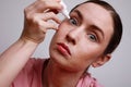 Headshot of woman with injured eye inserting eye-drop. Health care and eyesight concept. Conjuctivitis. Space for space.