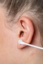 Healing abscess Inflammation on the ear, area of suppuration. Ear furuncle. Purulent carbuncle. Treatment of abscess Royalty Free Stock Photo