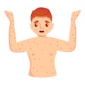 Health care measles icon, cartoon style