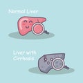 Health liver vs cirrhosis liver