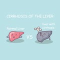 Health liver vs cirrhosis liver