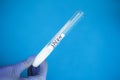 Health. Sample sperm. Donor Sperm. Close up Concept of Bank Sperm. Copyspace. Test Tube with Sperm Royalty Free Stock Photo