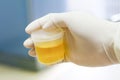 Healthcare And Medicine. Medical urine test, close-up