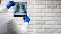 A healthcare professional examines the chest film. Chest x-ray of a person in the hands of a doctor, x-ray of the lungs. Royalty Free Stock Photo