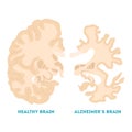 Healthy and alzheimer brain. Neurodegeneration concept illustration