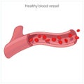 Healthy blood vessel vector illustration Royalty Free Stock Photo