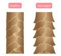 Healthy and damaged hair cuticle illustration. hair care and beauty concept