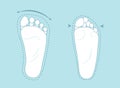 Healthy and deformed human feet comparison. Barefoot shoes vs regular shoes Royalty Free Stock Photo