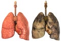 Lungs of a smoker Royalty Free Stock Photo