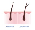 Healthy hair and split ends hair with scalp layer vector on white background.