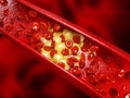 Healthy human red bloodcells and cholesterol plaques. 3d rendering concept Royalty Free Stock Photo