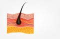 Healthy human skin layer with pores, and muscle tissue medical use, illustration