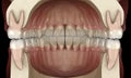 Healthy human teeth with normal occlusion, 3D Illustration