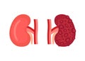 Healthy kidney and unhealthy disease kidney with polycystic. Check health of renal organ. Internal organ kidney. Vector