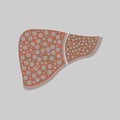A healthy liver and a liver with cirrhosis.