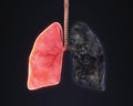 Healthy Lung and Smokers Lung Royalty Free Stock Photo