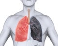 Healthy Lung and Smokers Lung Royalty Free Stock Photo