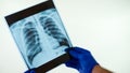Healthy lungs after pneumonia.Doctor looking at an x-ray.The doctor does an examination of the lungs.
