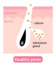 Healthy pores and sebum. sebaceous glands produce right amount of sebum,which keeps the skin great condition. Skin care concept