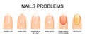 Healthy and problematic nails