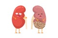 Healthy and sad suffering sick kidney with cancer characters. Human anatomy genitourinary system internal unhealthy