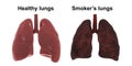 Healthy and smoker`s lungs isolated on white background, medical concept, Royalty Free Stock Photo