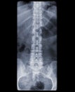 Healthy spine of a adult male on x-ray Royalty Free Stock Photo
