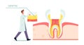 Healthy Teeth Anatomy and Structure Concept. Tiny Dentist Doctor in Mask and White Robe Put Part of Dentin on Huge Tooth Royalty Free Stock Photo