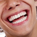 Healthy teeth closeup