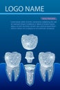 Healthy teeth and dental implant. Dentistry. Implantation of human teeth. Vector illustration