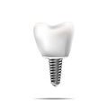 Healthy teeth and dental implant. Realistic illustration of tooth medical dentistry. Royalty Free Stock Photo