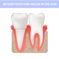 Healthy teeth and gum cross section, incisor and molar, vector